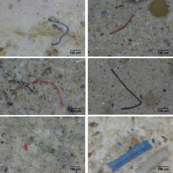 Detall dels microplàstics estudiats per la UAB Detall dels microplàstics estudiats per la UAB al delta de l'Ebre | ACNal delta de l'Ebre | ACN